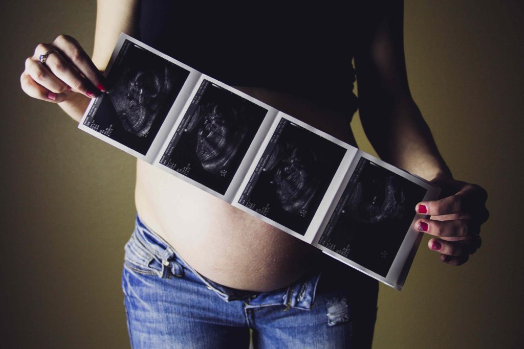 Ultrasound in pregnancy estimates fetal age and weight, including baby's profile